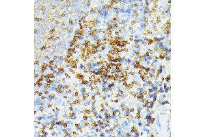 Immunohistochemistry of paraffin-embedded rat spleen using alpha 1 Spectrin antibody (ABIN6129333, ABIN6148401, ABIN6148402 and ABIN6215956) at dilution of 1:100 (40x lens). (SPTA1 Antikörper  (AA 940-1160))