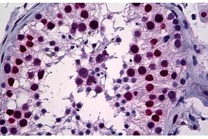 Human Testis: Formalin-Fixed, Paraffin-Embedded (FFPE) (YY1 Antikörper  (AA 221-321))
