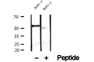 Western blot analysis of extracts of BxPC-3 cells, using VNN1 antibody. (VNN1 Antikörper)