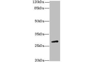 Western blot All lanes: TBC1D26 antibody at 3 μg/mL + Mouse liver tissue Secondary Goat polyclonal to rabbit IgG at 1/10000 dilution Predicted band size: 29, 25, 10 kDa Observed band size: 29 kDa (TBC1D26 Antikörper  (AA 1-250))