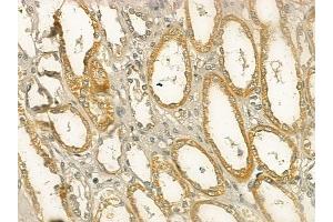 ABIN6266028 and ABIN6273347 at 1/100 staining human normal kidney tissue by IHC-P. (WISP1 Antikörper  (C-Term))