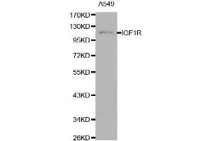 Western blot analysis of extracts of A549 cells using IGF1R antibody. (IGF1R Antikörper  (AA 660-760))