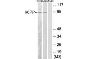 Western Blotting (WB) image for anti-phosphofructokinase, Platelet (PFKP) (AA 341-390) antibody (ABIN2889539)