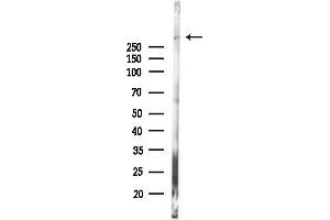 anti-Desmoplakin (DSP) (C-Term) antibody