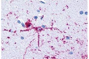Anti-GRM8 / MGLUR8 antibody  ABIN1048945 IHC staining of human brain, neurons and glia. (GRM8 Antikörper  (N-Term))