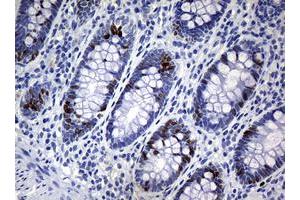 Image no. 4 for anti-Antigen Identified By Monoclonal Antibody Ki-67 (MKI67) (AA 1160-1493) antibody (ABIN1490857) (Ki-67 Antikörper  (AA 1160-1493))