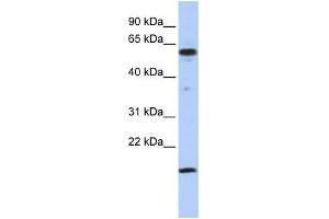 Human Jurkat; WB Suggested Anti-TRIP10 Antibody Titration: 0. (TRIP10 Antikörper  (Middle Region))