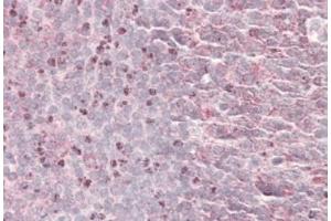 Septin-6 Antibody  staining of paraffin embedded Human Tonsil at 3. (Septin 6 Antikörper  (Internal Region))