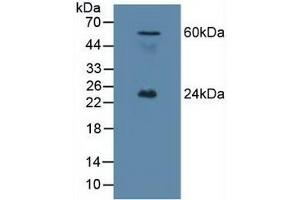Detection of EFNA1 in Mouse Testis Tissue using Polyclonal Antibody to Ephrin A1 (EFNA1) (Ephrin A1 Antikörper  (AA 19-182))