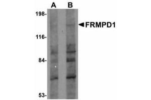 Image no. 1 for anti-FERM and PDZ Domain Containing 1 (FRMPD1) (C-Term) antibody (ABIN478185) (FRMPD1 Antikörper  (C-Term))