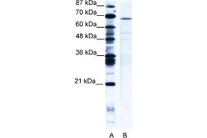 WB Suggested Anti-PSIP1 Antibody   Titration: 5 ug/ml   Positive Control: Jurkat Whole Cell PSIP1 is strongly supported by BioGPS gene expression data to be expressed in Human Jurkat cells (PSIP1 Antikörper  (Middle Region))