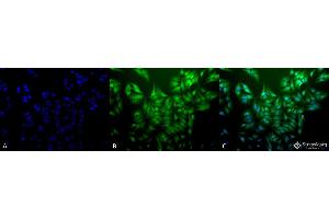 Immunocytochemistry/Immunofluorescence analysis using Mouse Anti-Ubiquitin Monoclonal Antibody, Clone 5B9-B3 . (Ubiquitin Antikörper  (FITC))