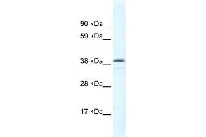 WB Suggested Anti-RORC Antibody Titration: 0. (RORC Antikörper  (C-Term))