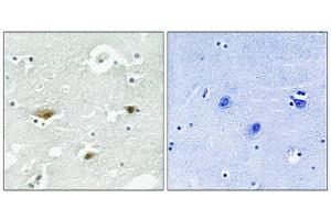 Immunohistochemical analysis of paraffin-embedded human brain tissue using STK39 (Phospho-Ser323) antibody (left)or the same antibody preincubated with blocking peptide (right). (STK39 Antikörper  (pSer325))