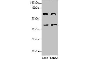 Western blot All lanes: DCP1A antibody at 3. (DCP1A Antikörper  (AA 303-582))