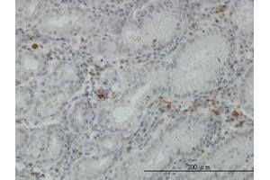 Image no. 3 for anti-Fibrinogen-Like 2 (FGL2) (AA 24-124) antibody (ABIN466173) (FGL2 Antikörper  (AA 24-124))