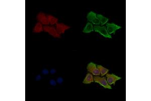 Phospho-CaMKII alpha (Ser331) Antibody staining HepG2 cells(serum starvation treatment) by IF/ICC. (CAMK2A Antikörper  (pSer331))