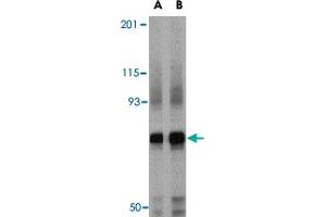 Western blot analysis of NCSTN in mouse brain tissue lysate with NCSTN polyclonal antibody  at (A) 0. (Nicastrin Antikörper  (Internal Region))
