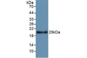 Detection of Recombinant APOL2, Human using Monoclonal Antibody to Apolipoprotein L2 (APOL2) (Apolipoprotein L 2 Antikörper  (AA 186-337))