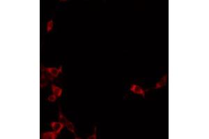 ABIN6272341 staining A549 by IF/ICC. (ST14 Antikörper  (Internal Region))