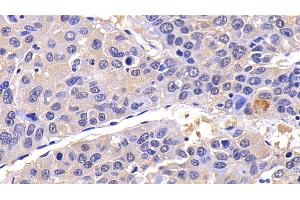 Immunohistochemistry (IHC) image for anti-Caspase 8 (CASP8) (AA 217-384) antibody (ABIN7432745)