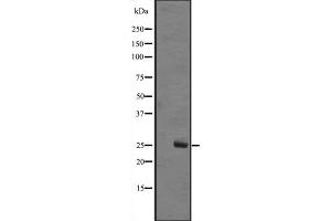 Western blot analysis of MOBKL1B expression in A431 whole cell lysate ,The lane on the left is treated with the antigen-specific peptide. (MOB1A Antikörper  (Internal Region))