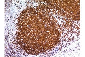 Immunohistochemistry (IHC) image for anti-Membrane-Spanning 4-Domains, Subfamily A, Member 1 (MS4A1) antibody (ABIN6941107)