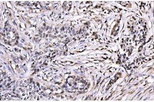 IHC analysis of CBX1/HP1 beta using anti-CBX1/HP1 beta antibody (ABIN7602012). (CBX1 Antikörper  (AA 55-185))