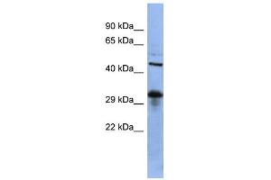 WB Suggested Anti-SOX2 Antibody Titration:  0. (SOX2 Antikörper  (Middle Region))