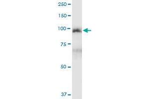 Immunoprecipitation (IP) image for anti-Mutated in Colorectal Cancers (MCC) (AA 1-829) antibody (ABIN950122)