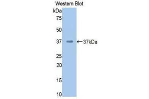 Western Blotting (WB) image for anti-Coagulation Factor II (thrombin) (F2) (AA 325-618) antibody (ABIN3207761) (Prothrombin Antikörper  (AA 325-618))