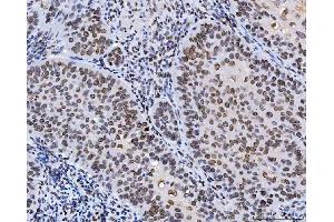 IHC analysis of Lamin A+C/LMNA using anti-Lamin A+C/LMNA antibody (ABIN7601843).