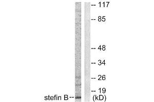 Western Blotting (WB) image for anti-Cystatin B (Stefin B) (CSTB) (Internal Region) antibody (ABIN1848780) (CSTB Antikörper  (Internal Region))