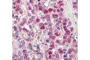 IHC analysis of FFPE human spleen tissue stained with MMP9 antibody (MMP 9 Antikörper  (AA 644-673))