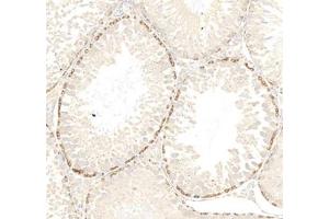 Immunohistochemistry analysis of paraffin embedded rat testis using PPP2R2C (ABIN7075278) at dilution of 1: 2000 (PPP2R2C Antikörper)