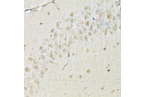 Immunohistochemistry of paraffin-embedded mouse brain using HDAC3 Antibody (ABIN5971166) at dilution of 1/100 (40x lens). (HDAC3 Antikörper)