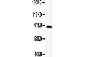 Anti- DISC1 antibody,  Western blotting All lanes: Anti DISC1 () at 0. (DISC1 Antikörper  (N-Term))