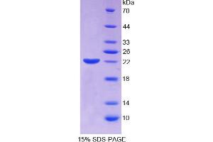 SDS-PAGE analysis of Human ECT2 Protein. (ECT2 Protein)