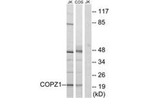Western blot analysis of extracts from Jurkat/COS cells, using COPZ1 Antibody. (COPZ1 Antikörper  (AA 11-60))