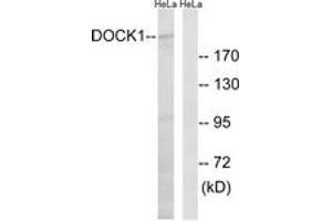 Western blot analysis of extracts from HeLa cells, using DOCK1 Antibody. (DOCK1 Antikörper  (AA 1661-1710))