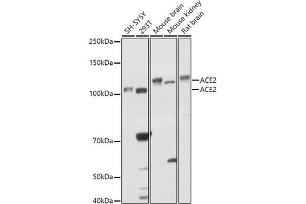 ACE2 Antikörper  (AA 18-250)