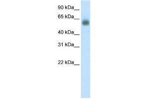 WB Suggested Anti-GRHL3 Antibody Titration: 0. (GRHL3 Antikörper  (C-Term))