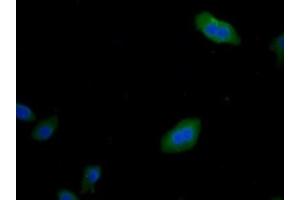 Detection of CNX in Human HepG2 Cells using Monoclonal Antibody to Calnexin (CNX) (Calnexin Antikörper  (AA 239-461))