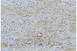 ABIN6274528 at 1/100 staining Mouse muscle tissue by IHC-P.