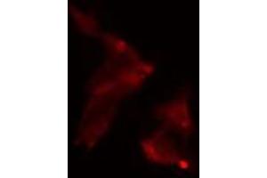 ABIN6275084 staining  LOVO cells by IF/ICC. (RNF111 Antikörper  (C-Term))