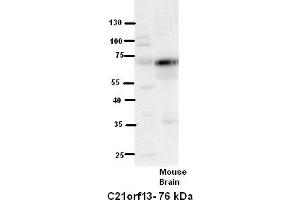 WB Suggested Anti-C21orf13 Antibody Titration:  5% Milk  ELISA Titer:  dilution: 1:500  Positive Control:  Mouse Brain lysate