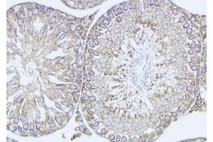 ABIN6272903 at 1/100 staining Mouse testis tissue by IHC-P. (ODF2 Antikörper  (Internal Region))