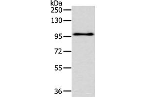 Western blot analysis of Hela cell using EPHA3 Polyclonal Antibody at dilution of 1:400 (EPH Receptor A3 Antikörper)