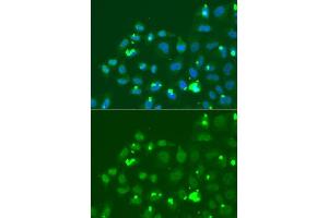 Immunofluorescence analysis of A549 cell using ATF3 antibody. (ATF3 Antikörper  (AA 1-181))