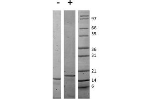 SDS-PAGE of Mouse Interleukin-16 Recombinant Protein SDS-PAGE of Mouse Interleukin-16 Recombinant Protein. (IL16 Protein)